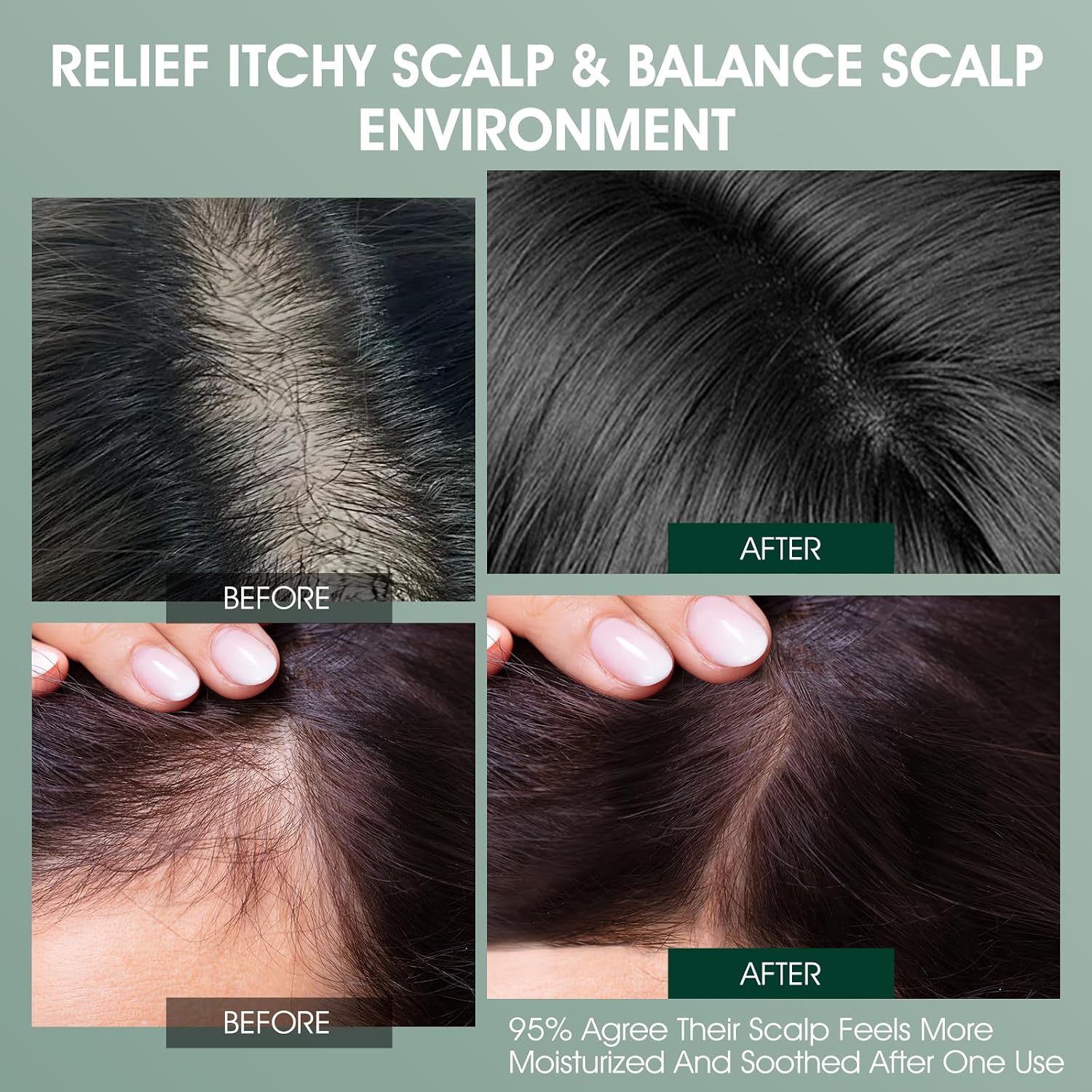 Rosemary & Tea Tree Scalp Treatment, Leave In Scalp Exfoliating, 120 ML | Anti-Dandruff, Dry & Itchy Scalp Relief, Hydrating Scalp Oil, Strengthens Hair Roots, Exfoliating Scalp Treatment